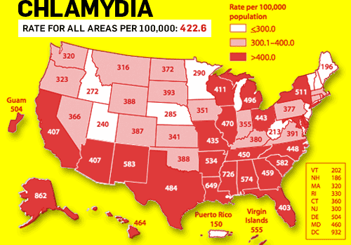 Signs of Chlamydia - Chlamydia Rates By State