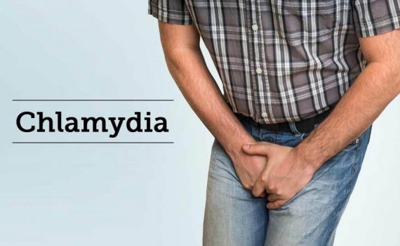 What is Chlamydia General Information On Chlamydia