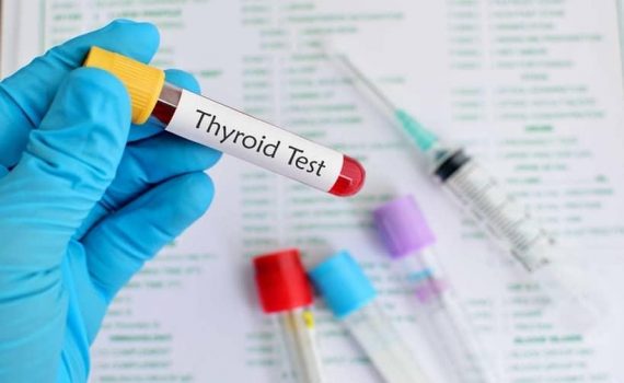 Thyroid Test – Thyroid Supplements