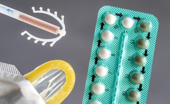9 Alternative Methods of Contraception